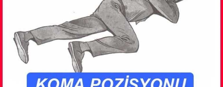 Koma Pozisyonu Nedir?